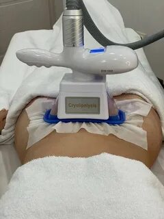 Криолиполиз спб