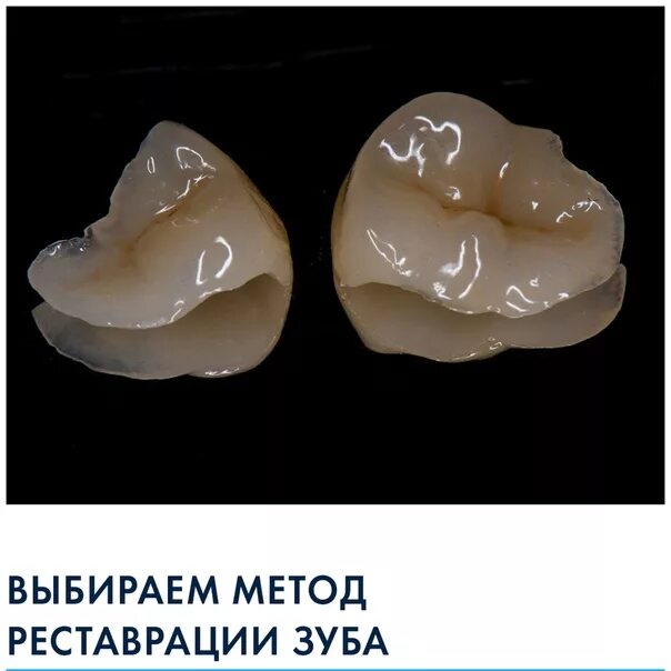 Материалы для временного пломбирования