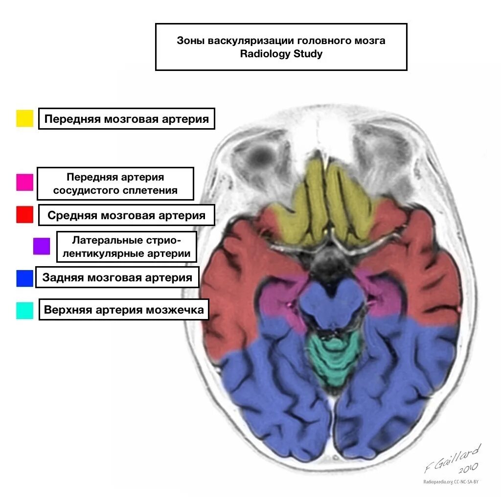 Сма мозга. Зоны кровоснабжения мозговых артерий кт. Бассейн передней мозговой артерии. Бассейны кровоснабжения головного мозга. Бассейны кровоснабжения головного мозга схема.