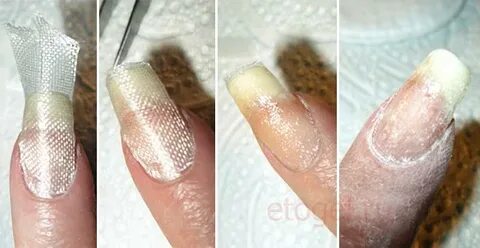 Чем можно заклеить ноготь
