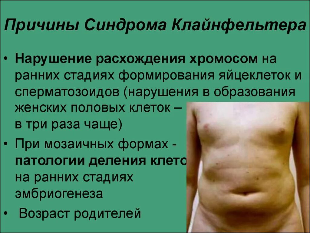 Почему синдром. Почему синдром