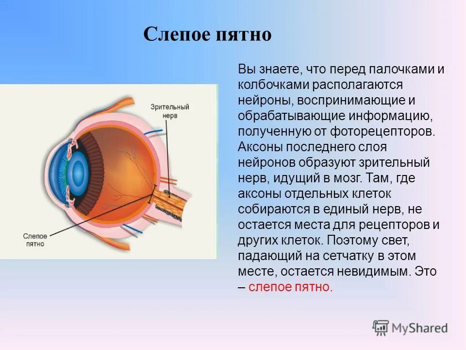 Содержит несколько слоев нейронов содержит роговицу защищает. Слепое пятно глаза функции. Зрительный анализатор слепое пятно. Строение глаза слепое пятно. Слепое пятно глаза строение и функции.