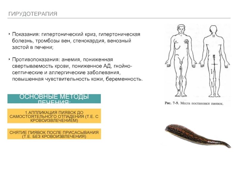 Гирудотерапия показания. Пиявки лечение показания польза и вред. Гирудотерапия памятка. Гирудотерапия в стоматологии. Гирудотерапия показания и противопоказания.