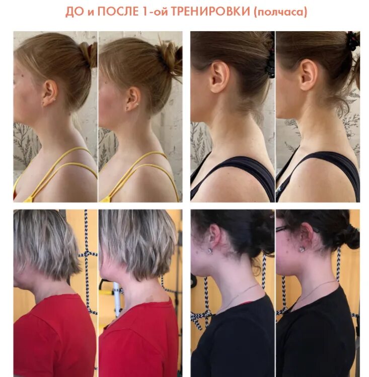 Как выглядит холка. Как выглядит холка. Вдовий горб какой массажёр купить. Как выглядит холка. Как выглядит холка.