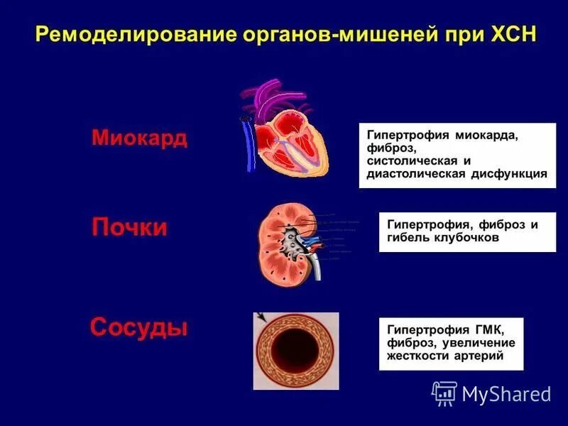 Органы мишени при сердечной недостаточности. Поражение органов мишеней при ХСН. Нарушением функции "органов-мишеней".