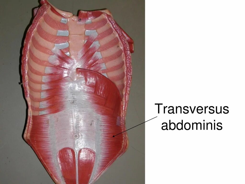 Поперечная мышца живота. Transversus abdominis. Musculus transversus abdominis. M transversus abdominis. Abdominis Thoracis.