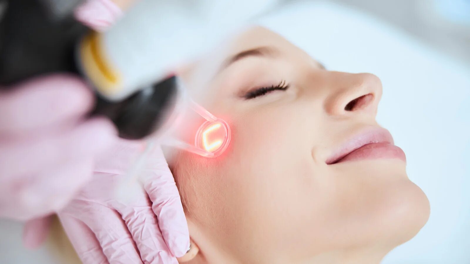 Лет терапия лица. Fractional co2 laser. лазерное омоложение лица.