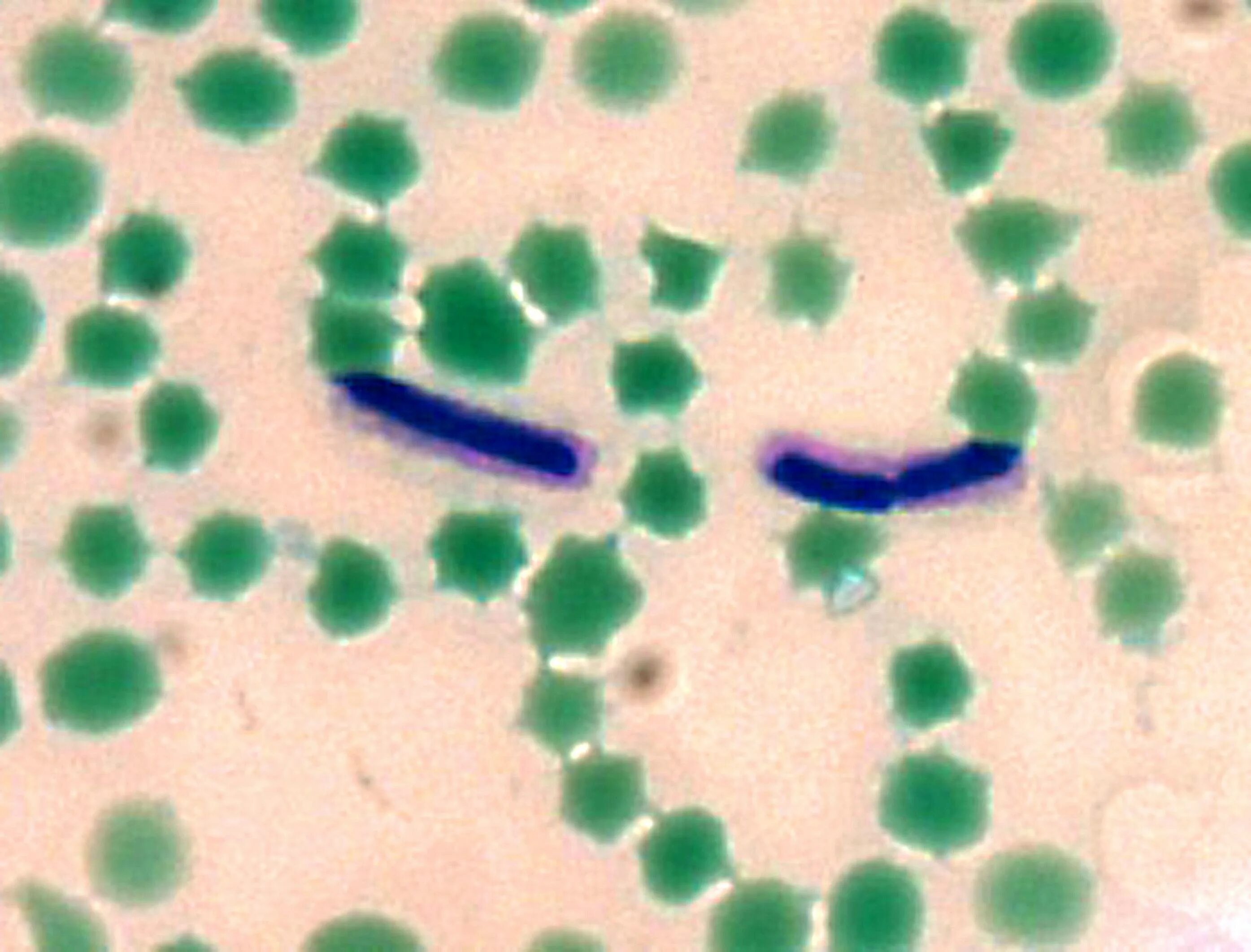 Bacillus anthracis Сибирская язва. Bacillus anthracis микроскопия.