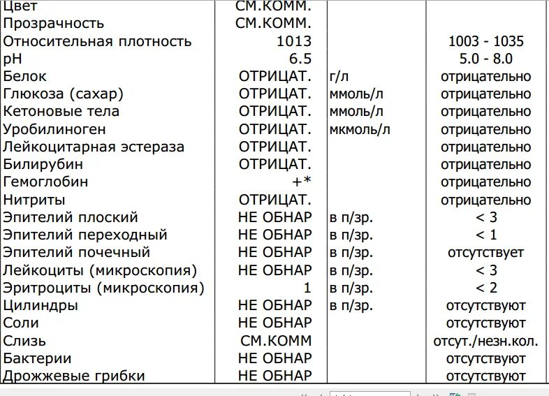 Полный анализ мочи. Анализ мочи общий расшифровка у взрослых норма в таблице у мужчин. Анализ мочи норма и расшифровка. Показатели общего анализа мочи расшифровка у женщин норма в таблице. Анализы мочи расшифровка и нормальные показатели у взрослых мужчин.