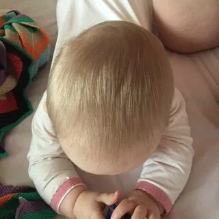 Кривая голова что делать