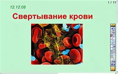 Кровотечения 8 класс биология. Свертывание крови 8 класс биология. Биология конспект свертывание крови 8 класса. Биология 8 класс конспект по теме кровь. Свертывание крови ЕГЭ биология.