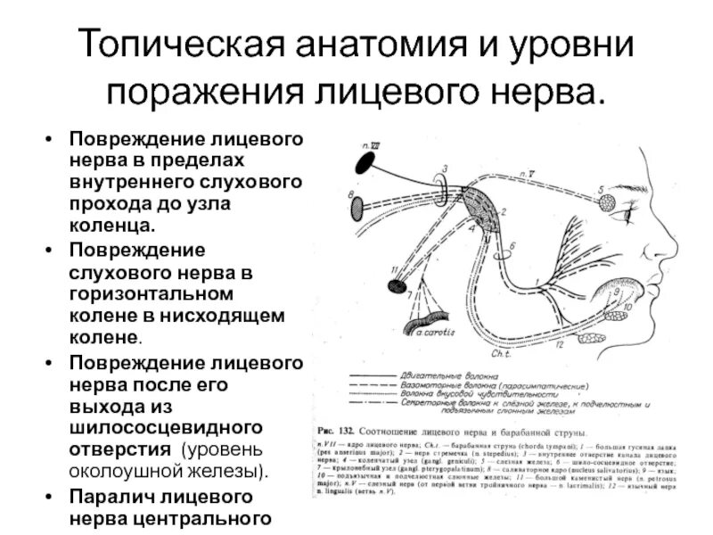 Уровни поражения тройничного нерва. Повреждение ветвей лицевого нерва. Поражение лицевого нерва очаг. Лицевой нерв неврология уровни поражения. Лицевой нерв после операции