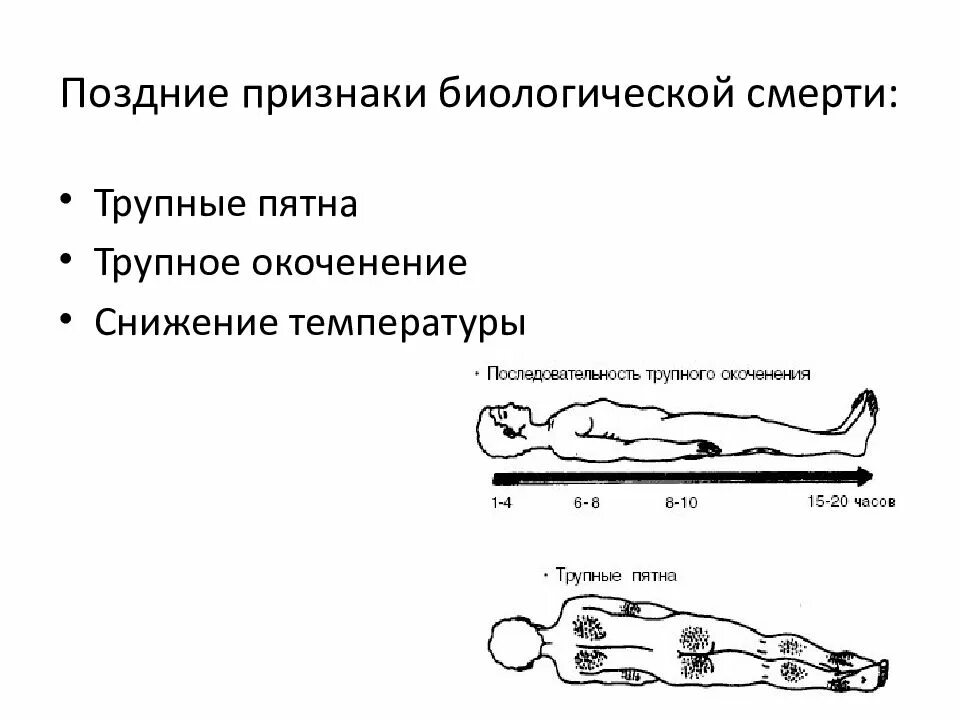 Трупное окоченение мышц. Признаки биологической смерти трупные пятна. признаки биологической смерти трупные пятна трупное окоченение. биологическая смерть признаки трупное окоченение. признаки наступления биологической смерти.