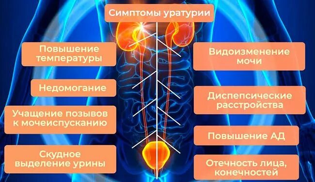 Уратурия это. Оксалатурия у детей. Ураты в моче. Оксалурия причины. Уратурия это.