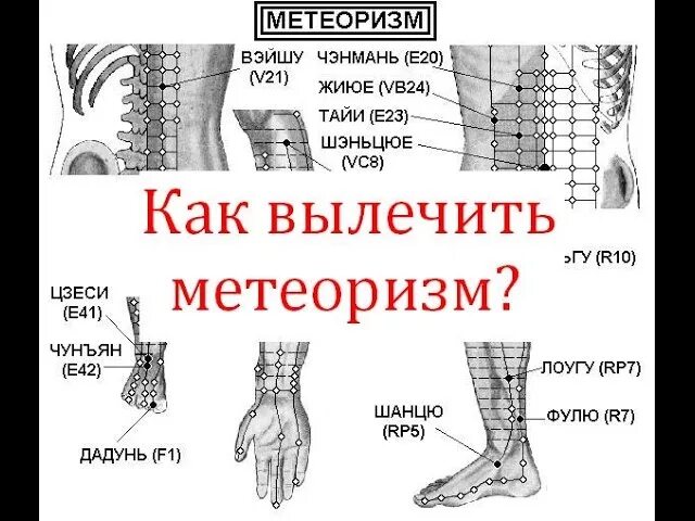 Как вылечить газообразование. Вылечить метеоризм. как лечить метеоризм. как вылечить метеоризм и газообразование. как лечить вздутие живота.