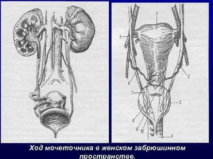 Мочеточник у женщин