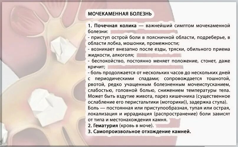 Мочекаменные колики. Мочекаменная болезнь почечная колика. С камнями в почках берут в армию. Мочекаменная болезнь симптомы.