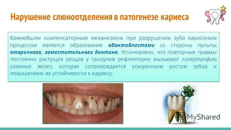 Механизм развития кариеса. Нарушение слюноотделения. Патогенез кариеса дентина. Повышенного слюноотделения.