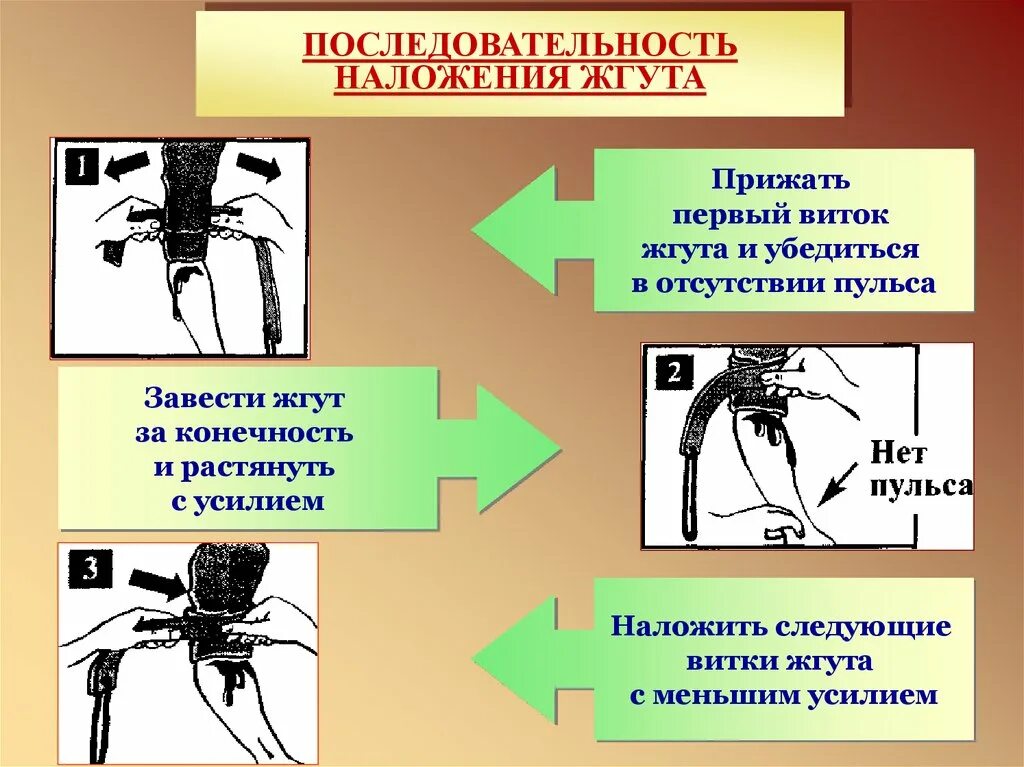 Последовательностьналожение жгута. Порядок наложения жгута. Последовательность при наложении жгута. Порядок накладывания жгута.