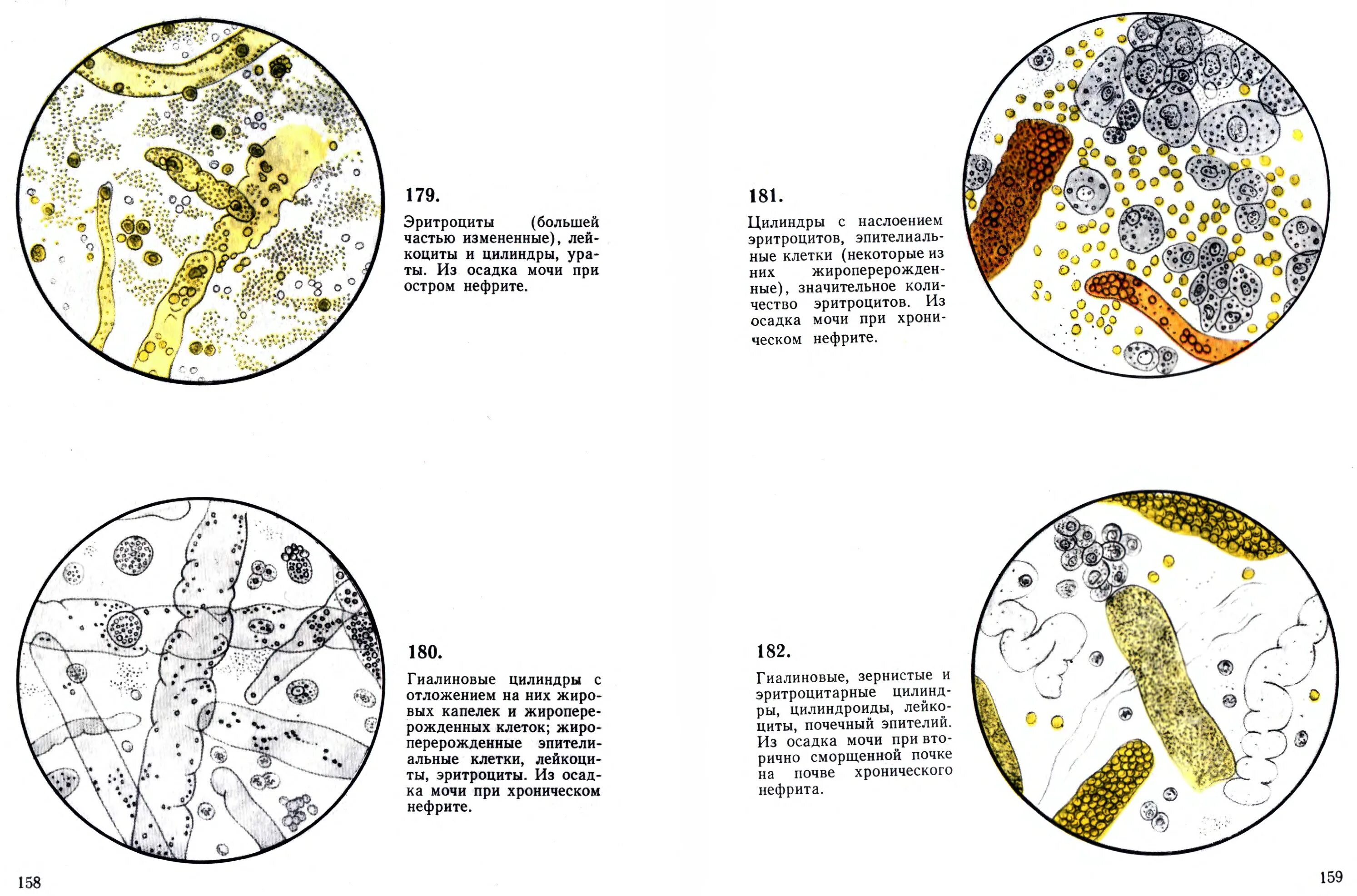 Микроскопия осадка мочи атлас. Краевский атлас микроскопии осадков мочи книга. Микроскопии осадков мочи Краевский в.я. Атлас микроскопии осадков мочи Краевский в.я.