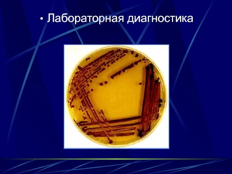 Гастроинтестинальная форма сальмонеллеза. Сальмонеллез презентация. Патогенез сальмонеллеза. Сальмонеллез птиц презентация. Лабораторная диагностика сальмонеллеза.