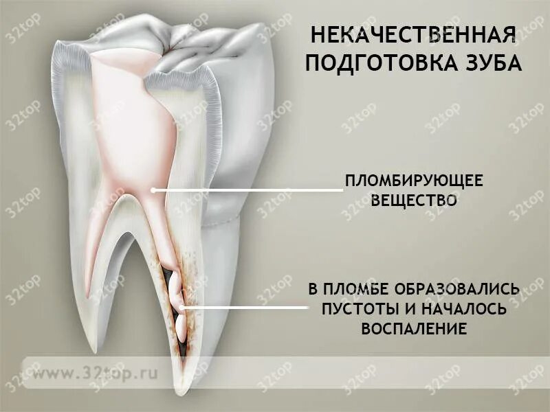 Причины почему болит зуб. Болит зуб.