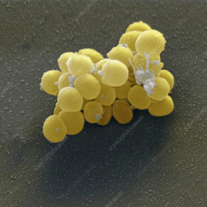 Staphylococcus aureus 5. S. aureus золотистый стафилококк. золотистый стафилококк морфология. стафилококк ауреус морфология. бактерии стафилококки 5 класс.