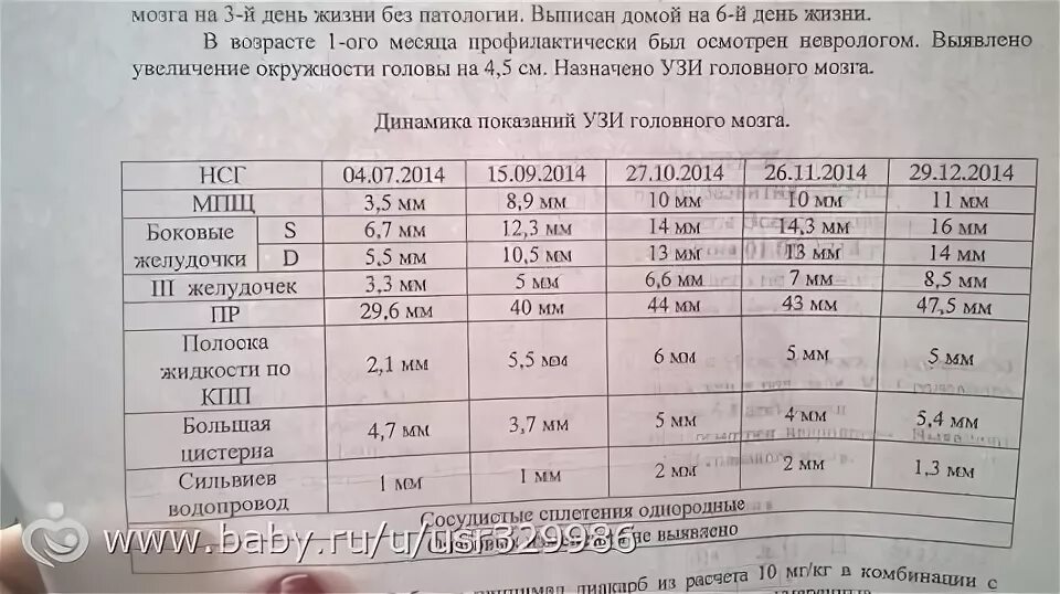 Нормы нсг. Норма УЗИ головного мозга у новорожденного. Нормальные показатели УЗИ головного мозга у детей. Нормы УЗИ головного мозга у грудничка. УЗИ головного мозга расшифровка норма таблица.