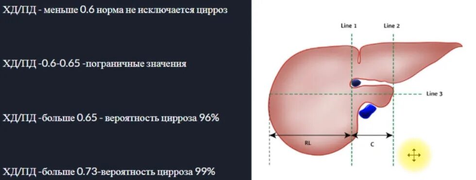 Ккр печени норма