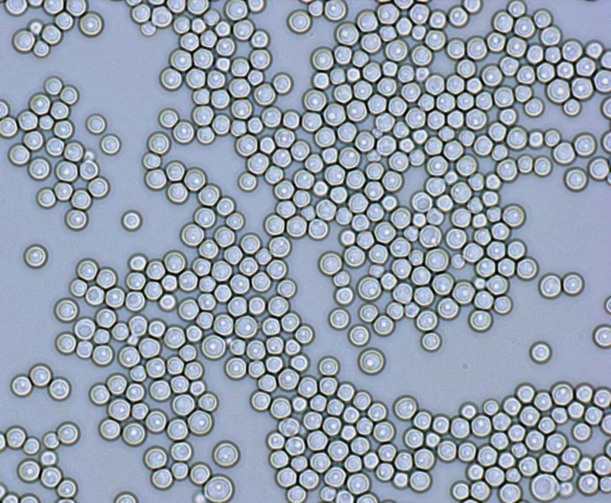 Микроскопия. Debaryomyces hansenii дрожжи. Saccharomyces Vini под микроскопом. Дебариомицес Хансен. Дрожжи Kluyveromyces marxianus.