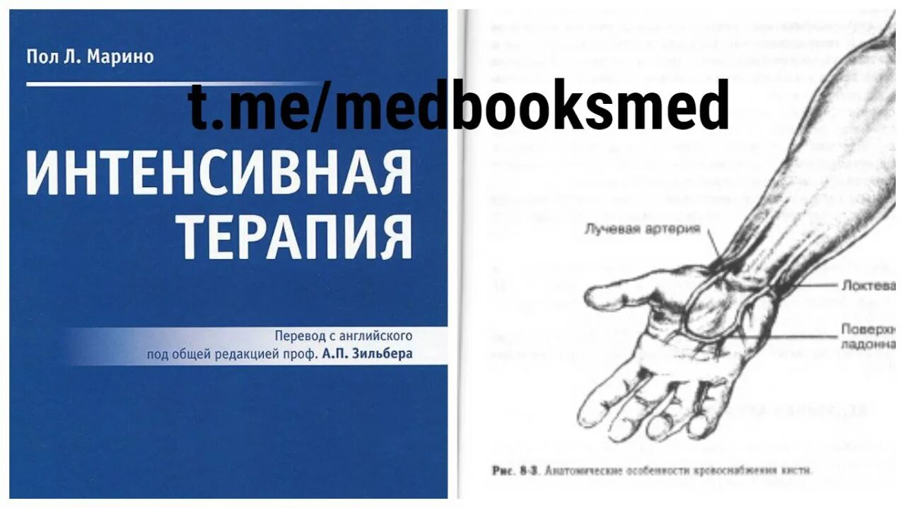 Пол марино. Пол Марине интесивная терапия. Интенсивная терапия Марино. Пол Марино интенсивная терапия. Пол Марино интенсивная терапия 2022.