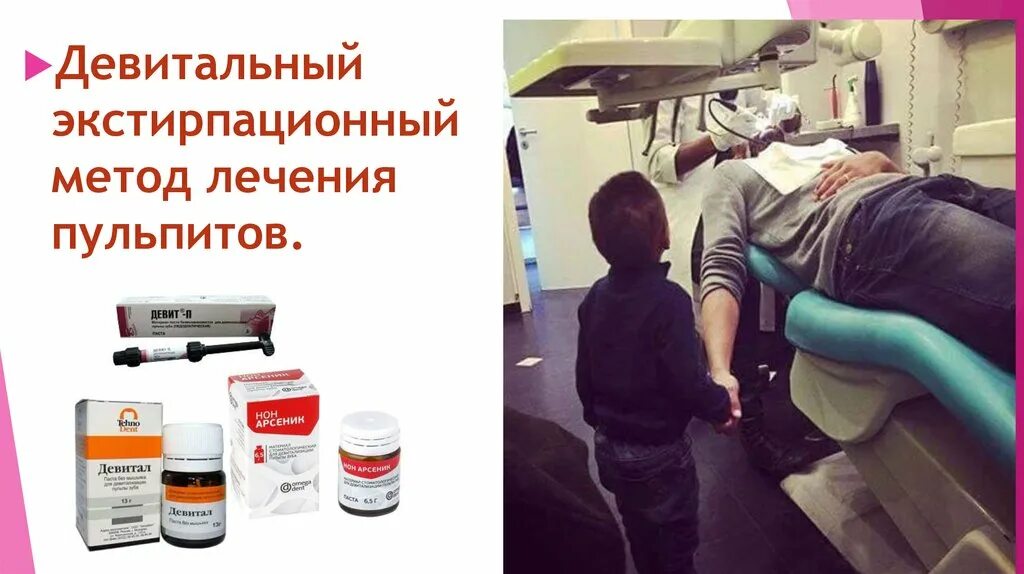 Пульпит метод девитальной экстирпации. Экстирпационный метод лечения пульпита. девитальные методы лечения пульпита. девитальный метод. девитальный метод лечения пульпита.