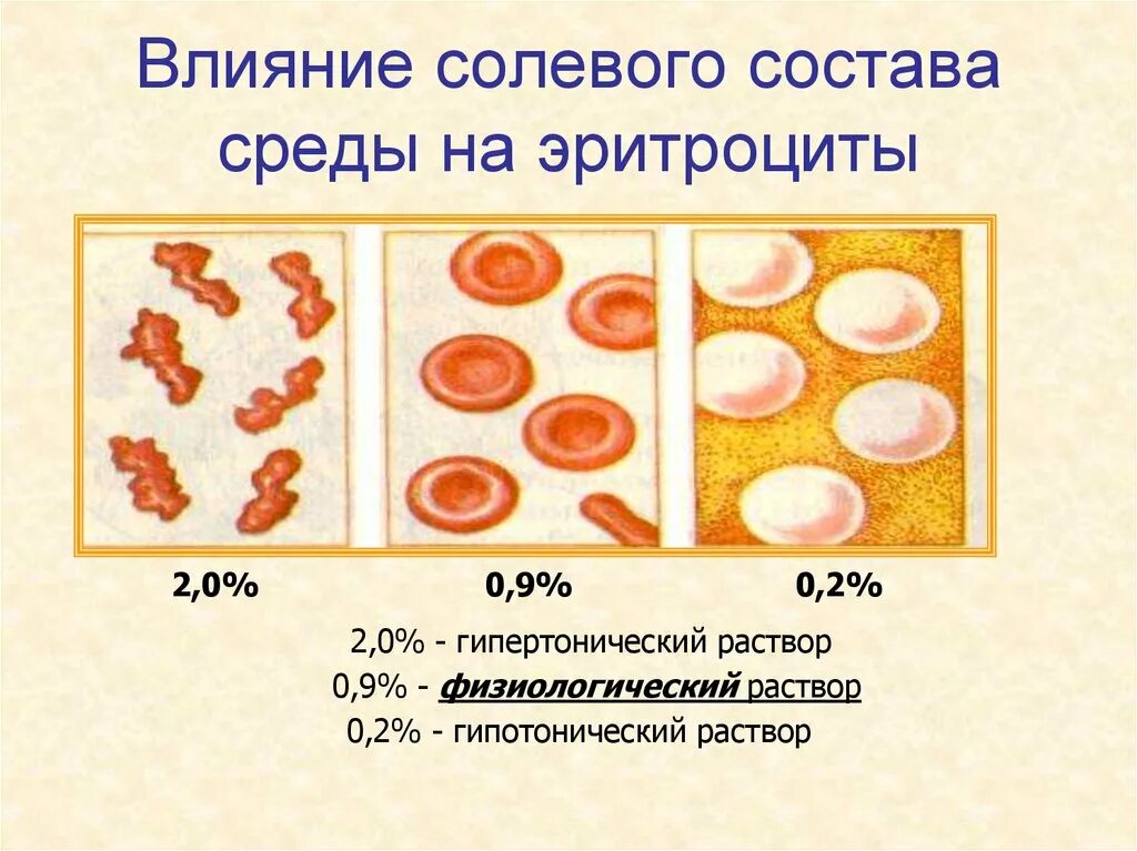 Экспериментатор поместил эритроциты в гипотонический. Эритроциты 0.9 раствор соли. эритроциты в растворе поваренной соли. влияние солевого состава среды на эритроциты. влияние солевого состава среды на эритроциты эритроциты.