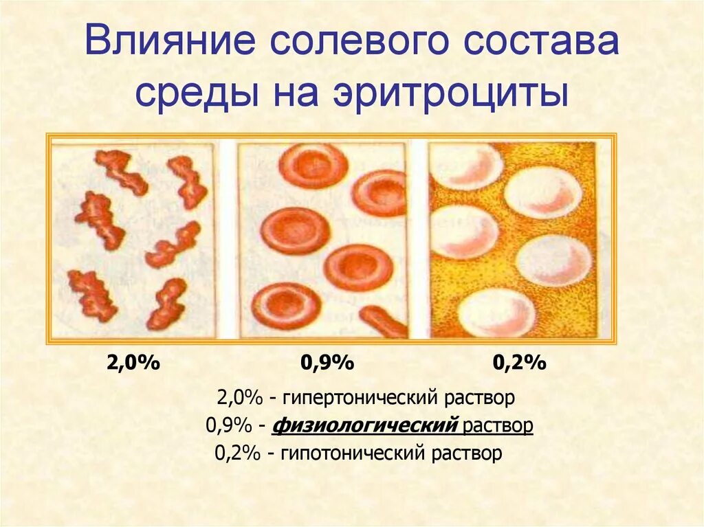 Влияние солевого раствора на эритроциты. Влияние солевого состава на эритроциты. Эритроциты 0.9 раствор соли. Эритроциты 0,2% раствора.