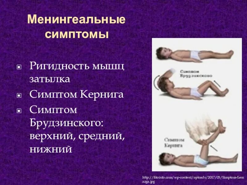 Тест на менингит. Менингеальные Брудзинского. Симптом Кернига и Брудзинского. Менингеальные рефлексы (Кернига, Брудзинского). Менингеальный синдром симптом Кернига.