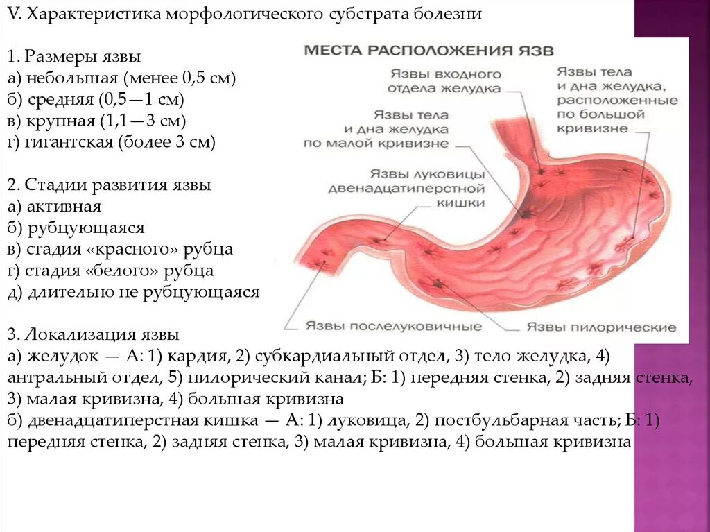 Плотный остро. Язвенная болезнь желудка и 12 перстной. Язва желудка в пилорическом отделе желудка. Терапия язвенной болезни 12 перстной кишки. Размеры язв желудка и 12-перстной кишки классификация.