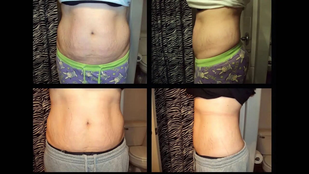 Горячее обертывание до и после. Обёртывание для похудения. Обертывание живота до и после. Обертывания от целлюлита до и после. После обертывание результаты до и после.