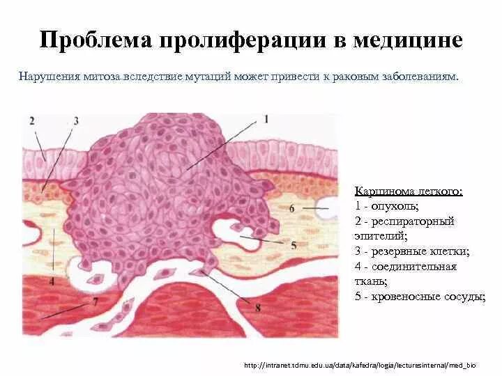 Пролиферация это простыми словами. Пролиферация клеток эпителия. Пролиферация это в патологии. Проблемы клеточной пролиферации в медицине. Пролиферация это гистология.