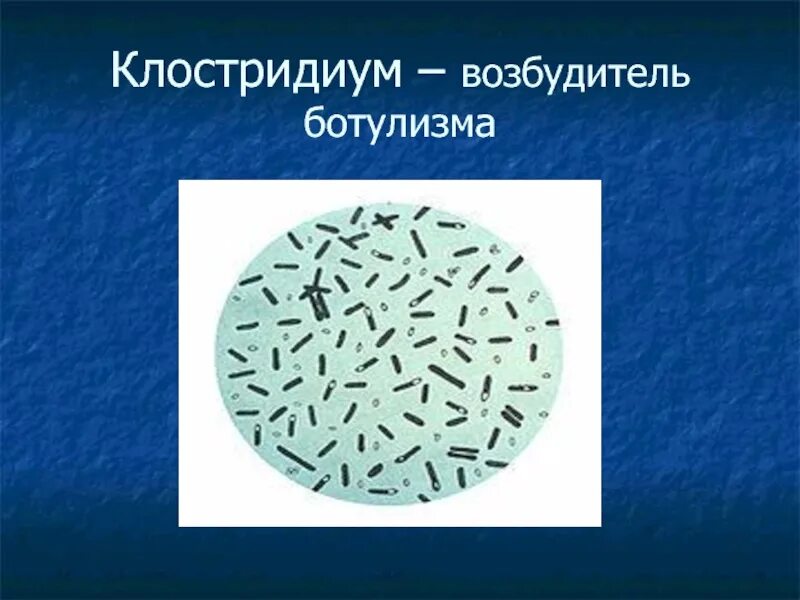 Клостридия ботулинум. Бактерии клостридии ботулизма. Клостридиум ботулинум микробиология. Clostridium botulinum микроскоп.