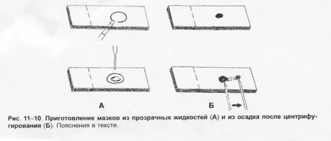 Метод толстого мазка