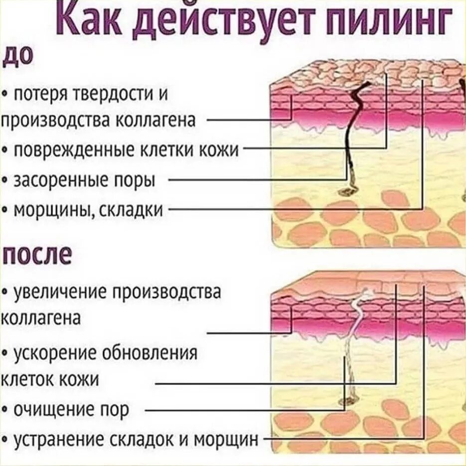 Воздействие пилинга на слои кожи. Строение кожи лица схема. Глубина воздействия пилингов. Строение кожи лица слои.