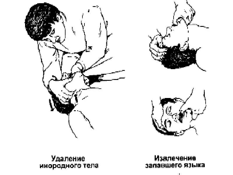 Что значит запавший