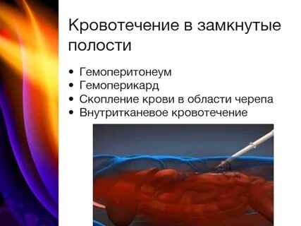 Кровотечение в полости