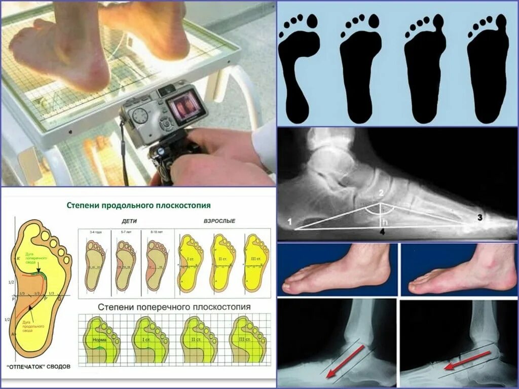 1 3 стопы
