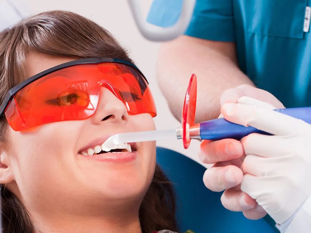 Пломба композита светоотверждаемого. Композитного светоотверждаемая пломба. Пломба из композита светового отверждения. Световая фотополимерная пломба. Световаясветовая пломба.