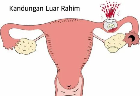 Контрацепция при сексе в попу- все нюансы