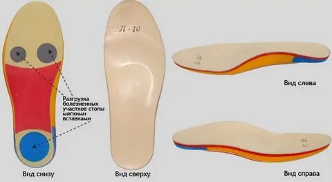 Как подобрать ортопедические стельки для обуви