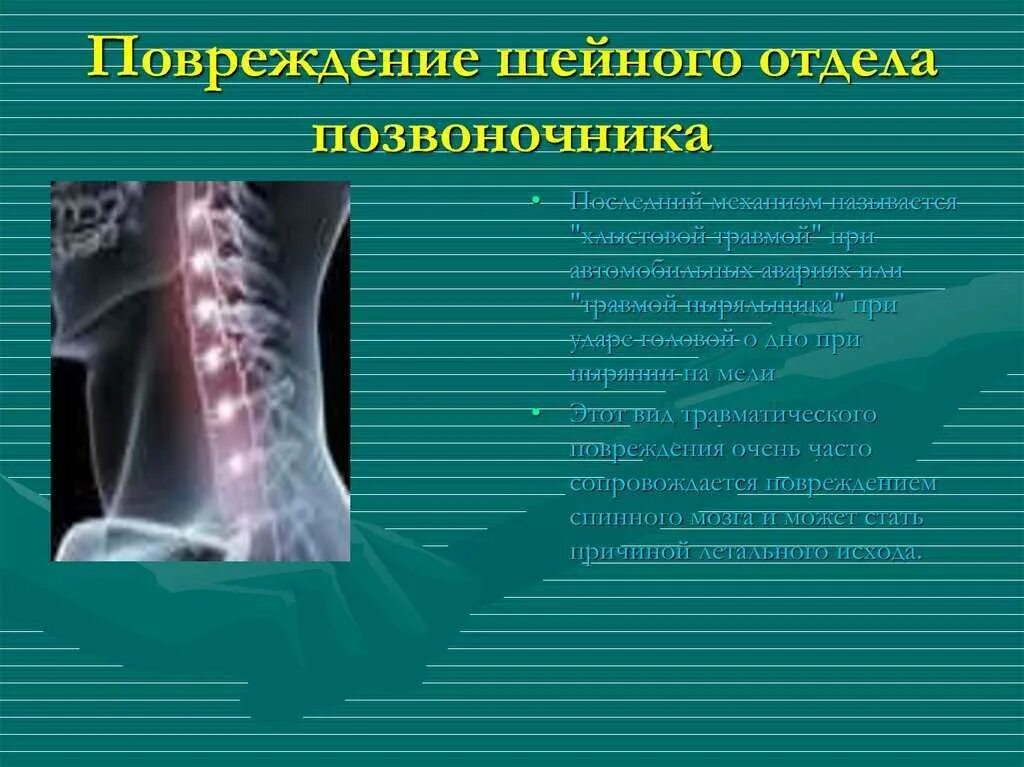 Сотрясение позвоночника. Повреждение шейного отдела позвоночника. Травма шейного отдела позвоночника. Шейная травма позвоночника. Шейный позвонок повреждение.