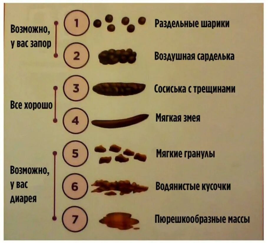 Почему какашки коричневых цветов. Виды кала. Виды стульев. Виды кала у человека. Виды кала у взрослого.