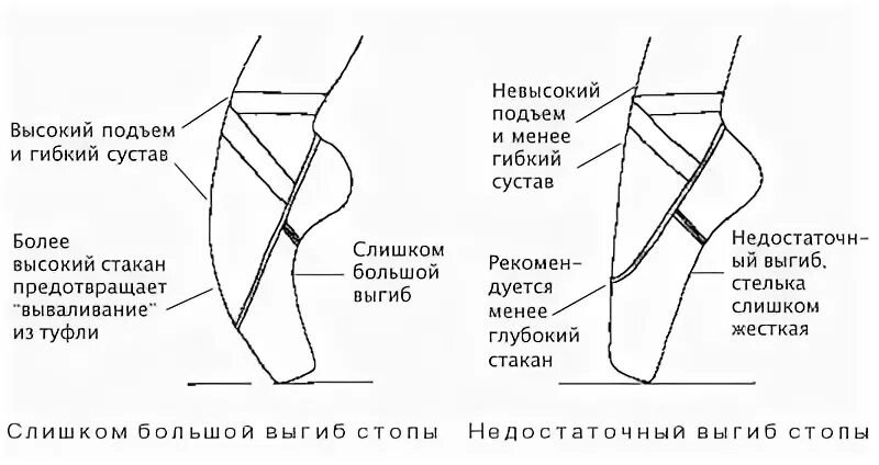 Высокий подъем как определить